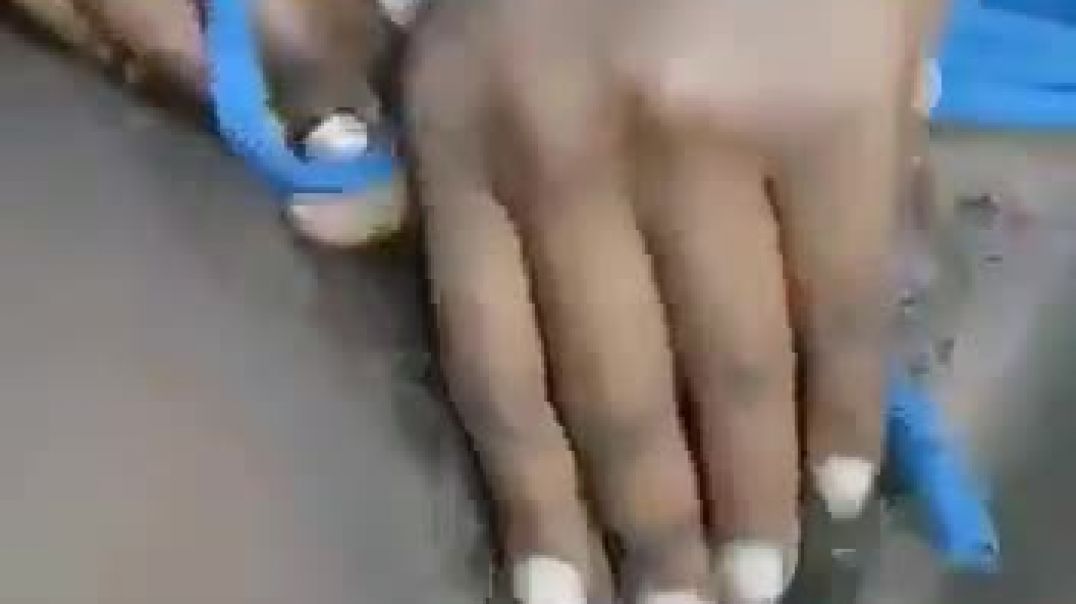 003645