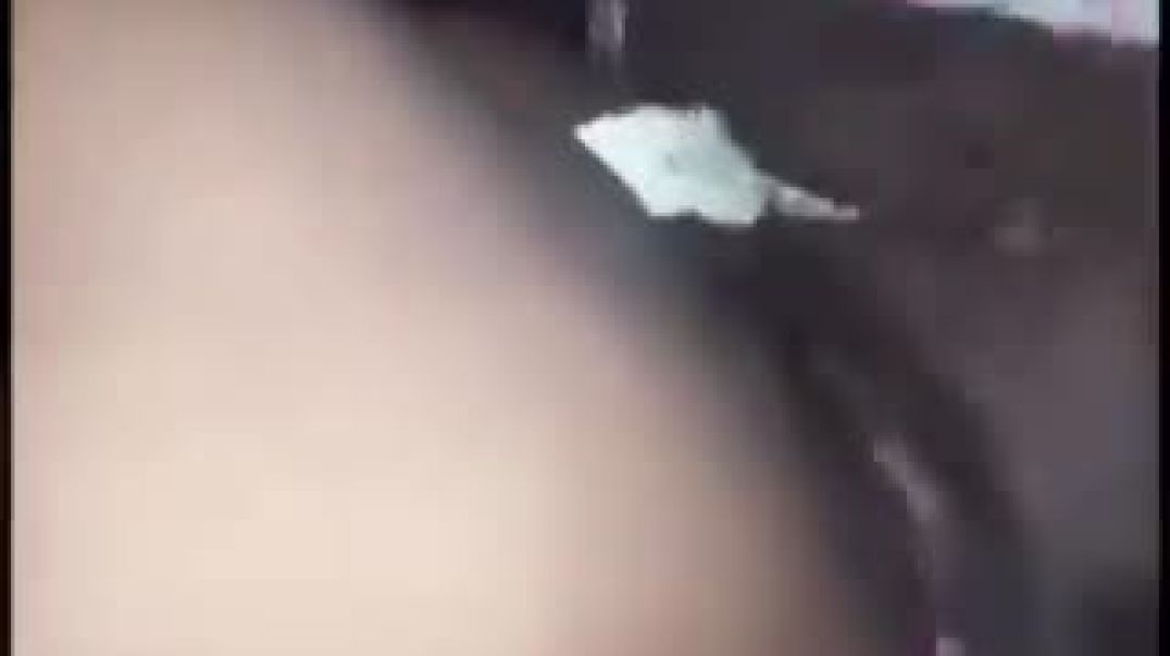 Snoring