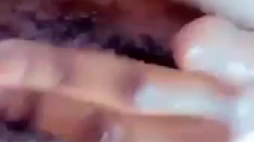 Massive pussy